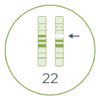 Chromosomenstörungen, Mikrodeletion 22q (DiGeorge-Syndrom)