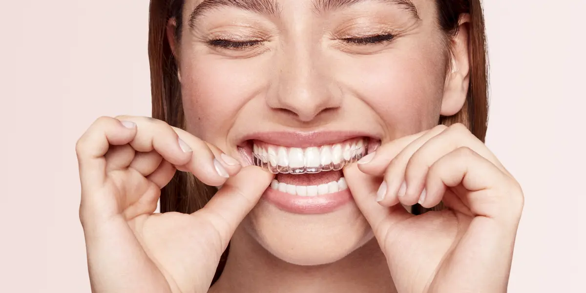 Gouttière dentaire : prix de l'orthodontie invisible