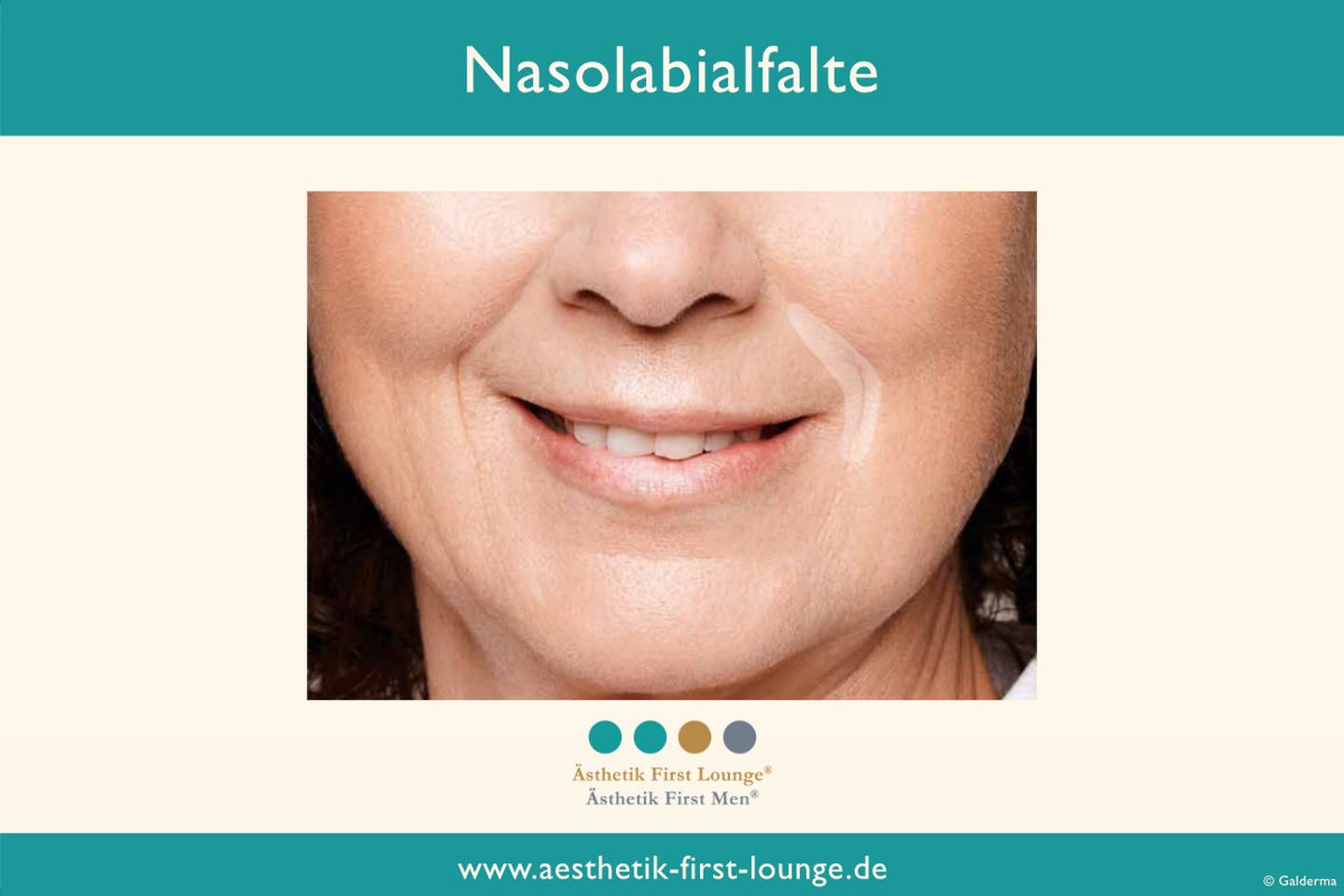 Falte Zwischen Nase Und Mund www.aesthetik-first-lounge.de