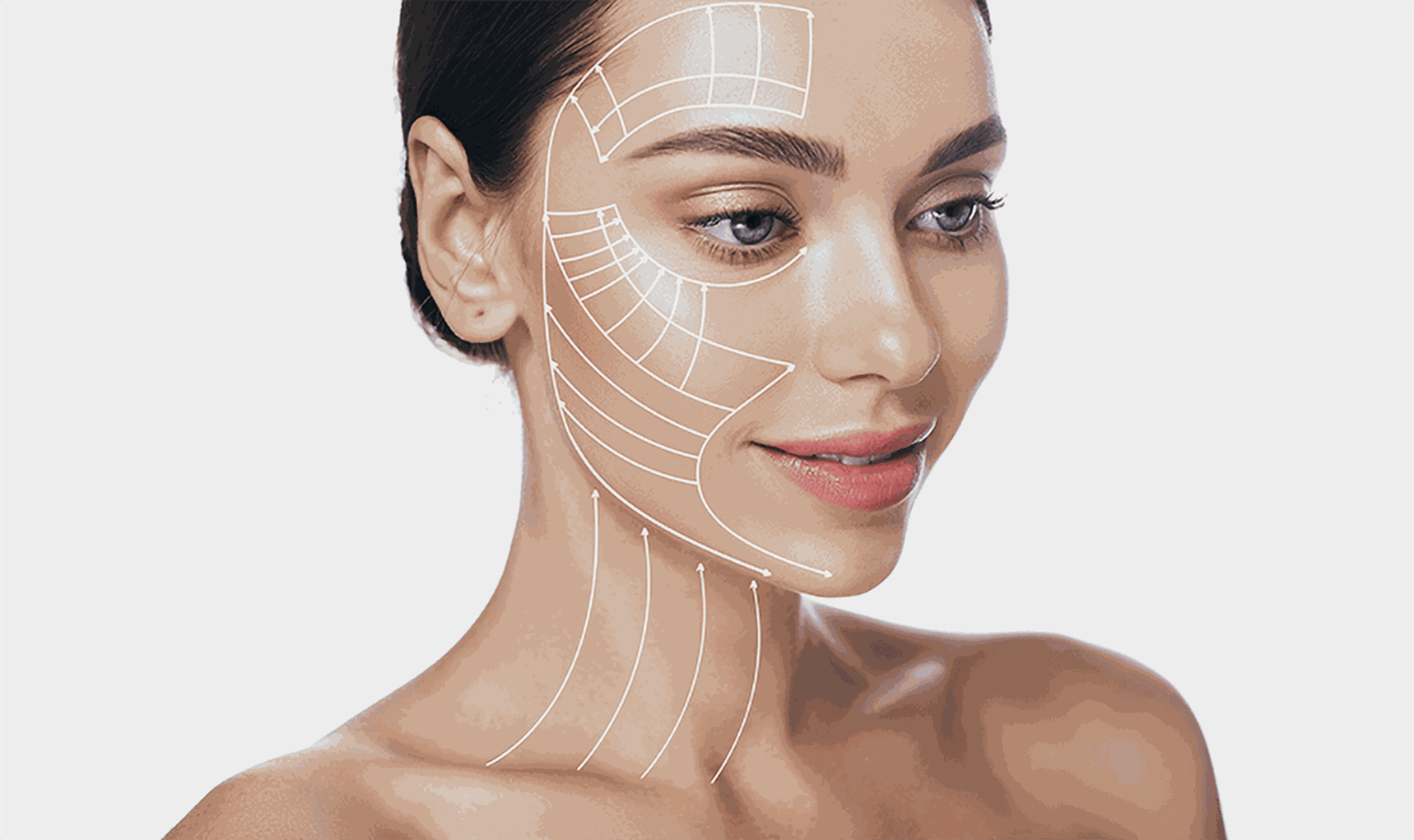 Gesicht einer Frau mit eingezeichnetem Schema zum Facelift