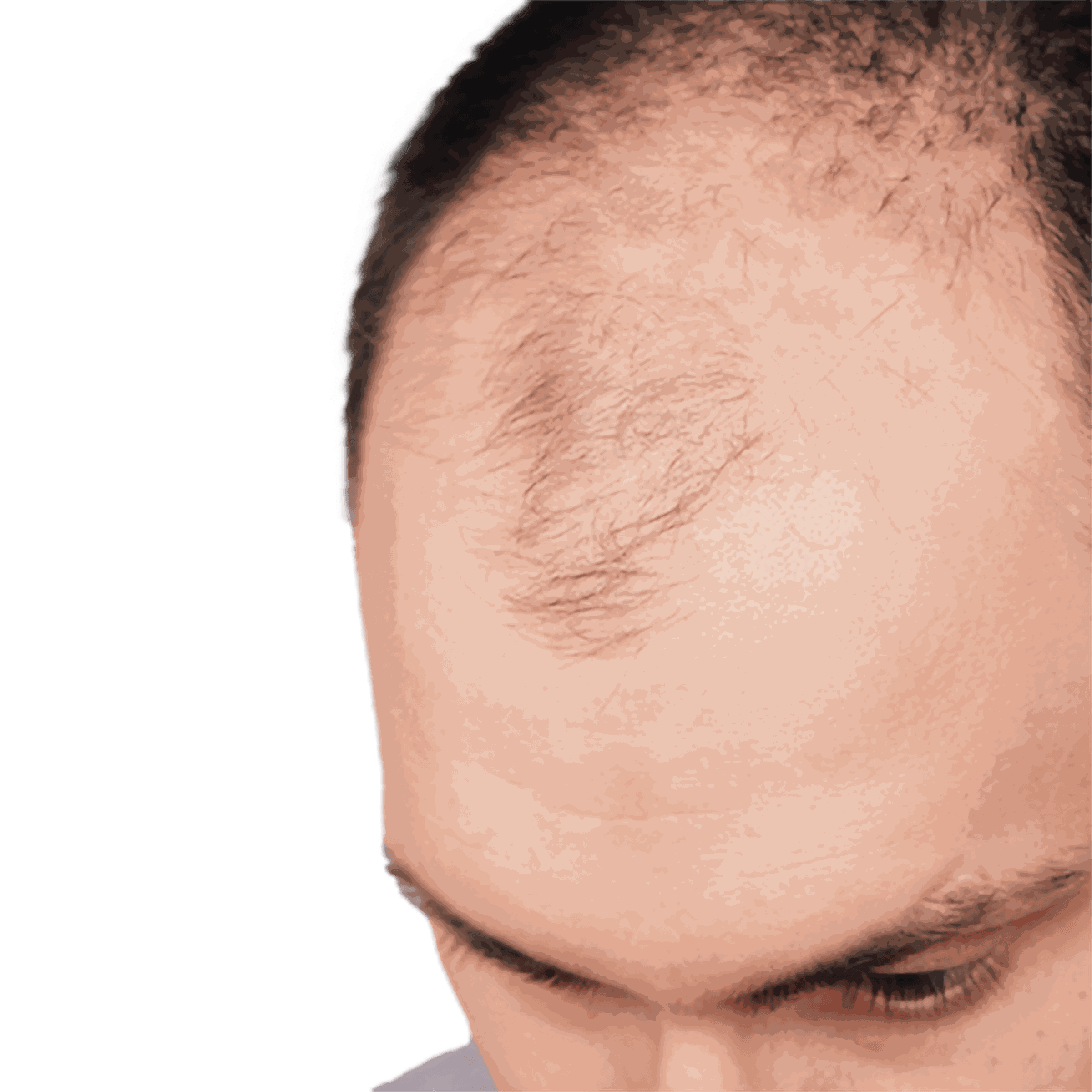 Kopf eines Mannes mit schütterem Haar.