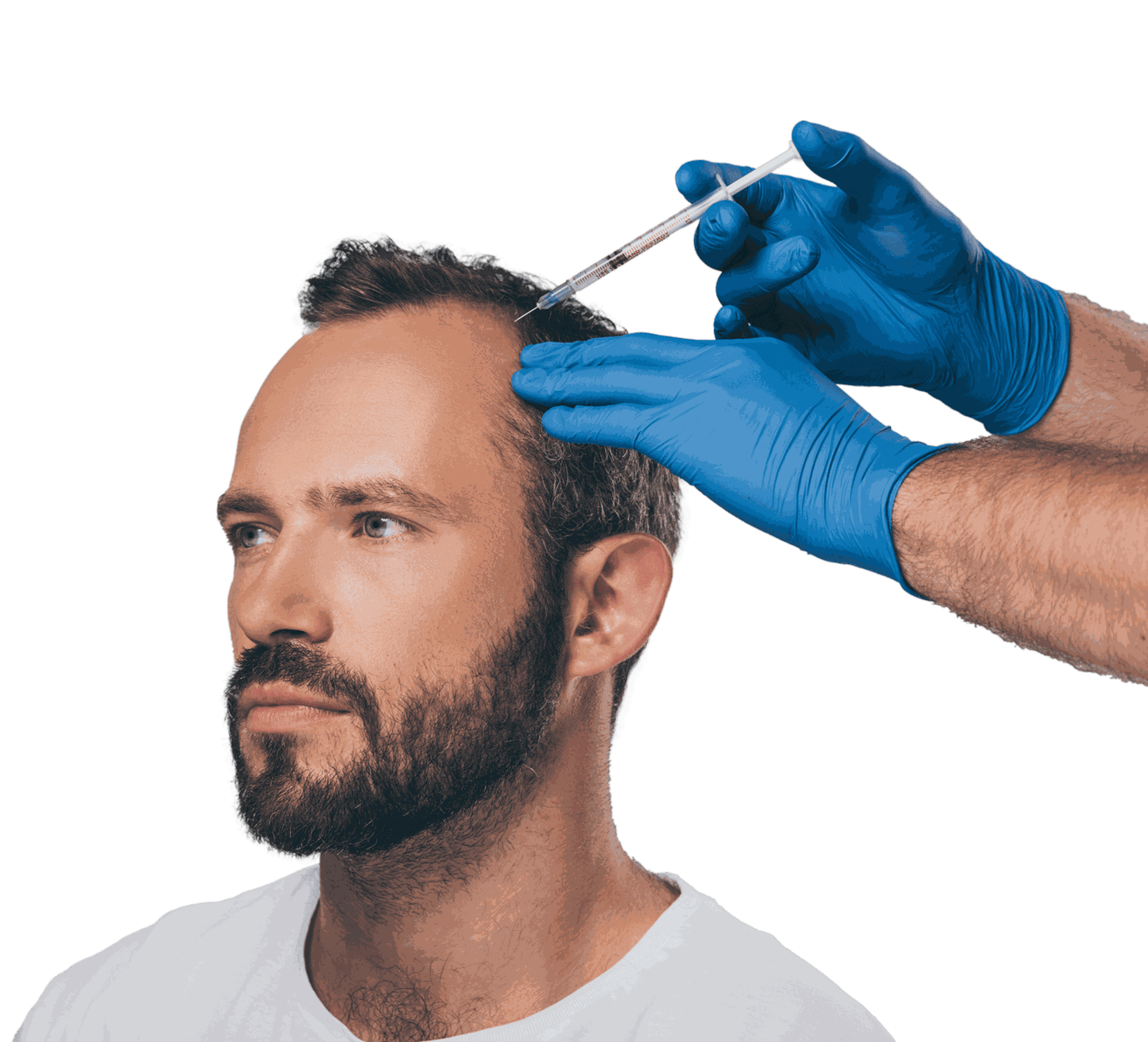 Arzt mit blauen Latexhandschuhen setzt eine Spritze am Kopf eines bärtigen Mannes mit schütterem Haar an