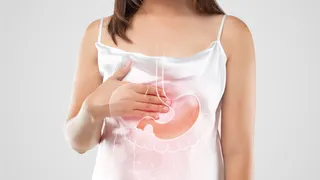 Ardor de estómago: qué es y cómo tratarlo