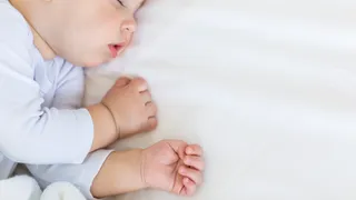 La hernia umbilical en los bebés