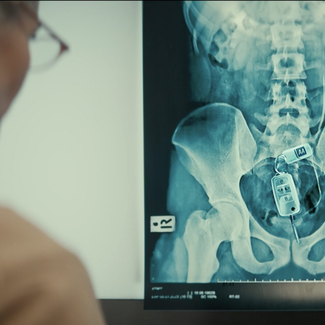 AA X Ray