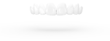 Wafer-thin ceramic shells for spotless teeth.