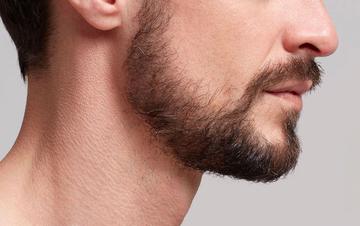 Beard Loss - HAIR & SKIN