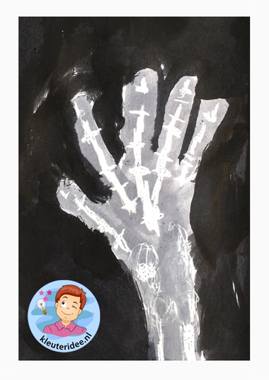 Röntgenfoto's maken met kleuters, kleuteridee