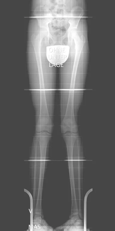 Röntgenaufnahme im Stehen