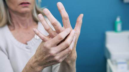 Frau mit Arthrose in Hand und Finger