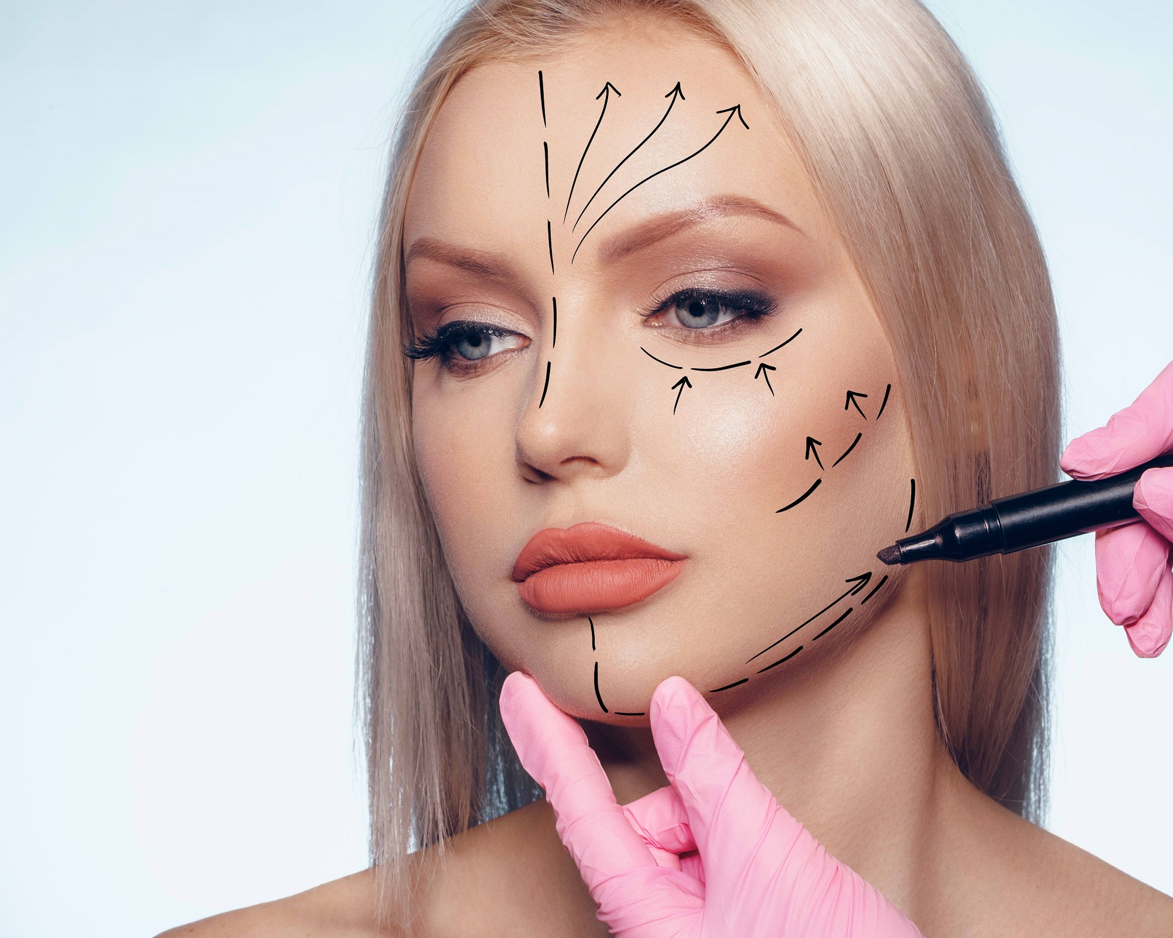 Schönheitschirurg zeichnet im Gesicht einer jungen Patientin strichlierte Linien ein
