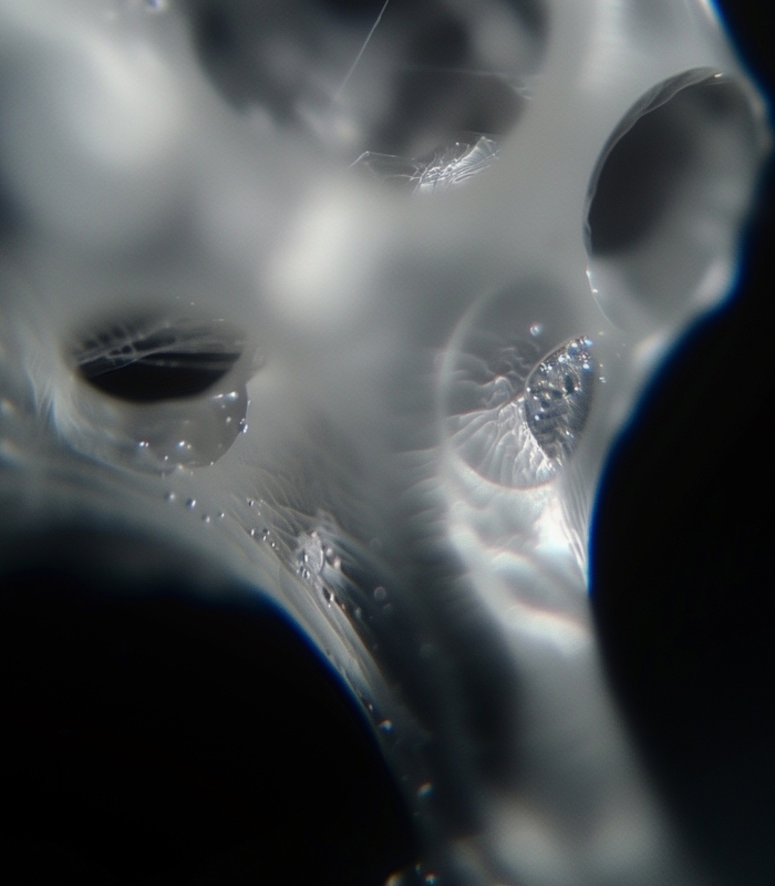 Microscopic image of porous calcium phosphate, CAM Bioceramics' material