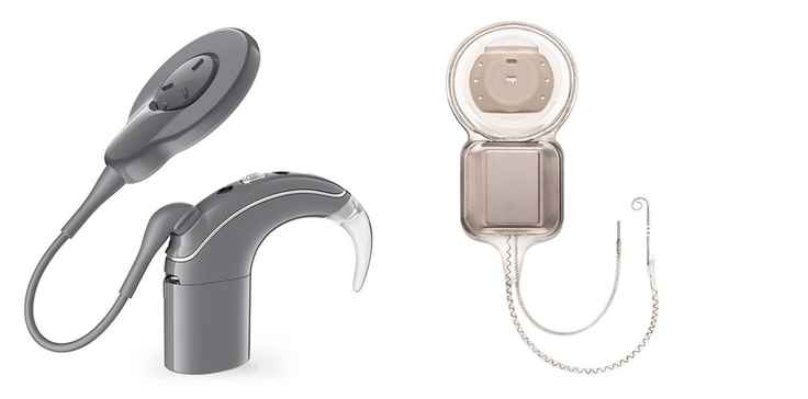 Technology of Hearing aids and implants