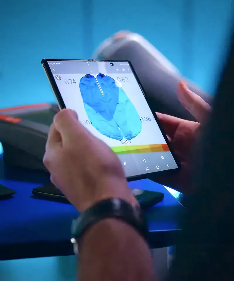 Tablet displaying a brain scan, from the Sound of Samsung Performance Enhancing Music campaign