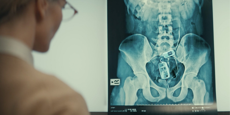 AA X Ray