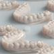 La stampa 3D in odontoiatria