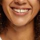 Zahnlücken schliessen mit transparenten Zahnspangen