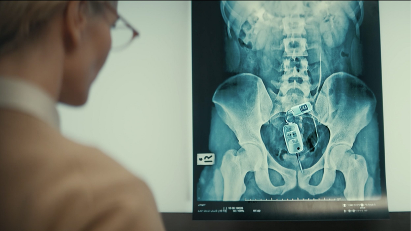 AA X Ray
