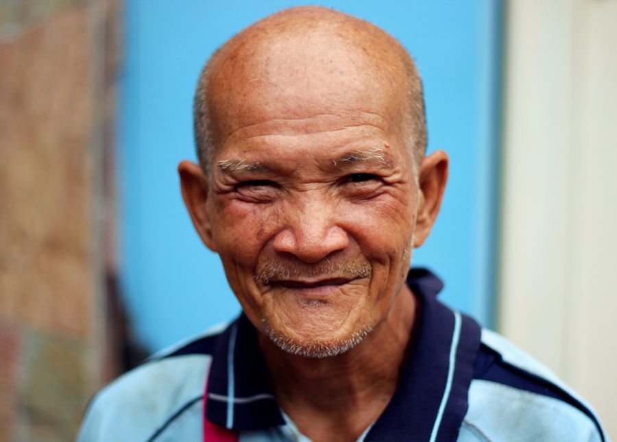 Stages of dementia- Photo of a balding older asian man smiling at the camera