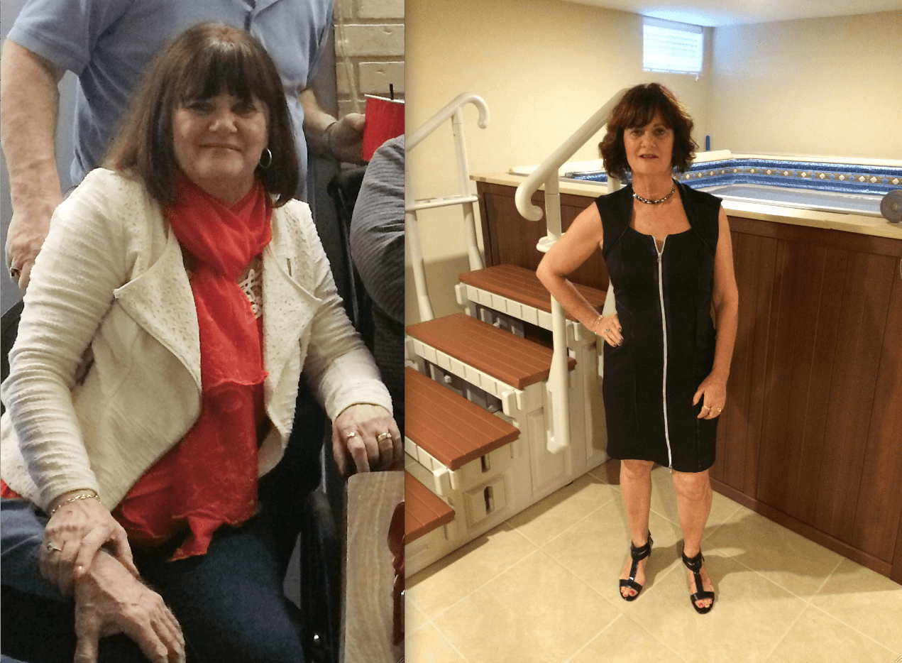 Deborah before and after she started using the Endless Pools WaterWell therapy pool