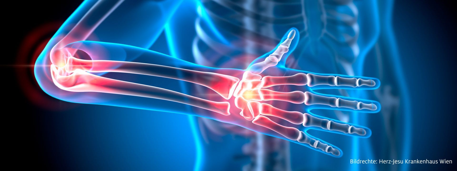 Kostenloser Infoabend: Gut leben trotz und mit Rheuma