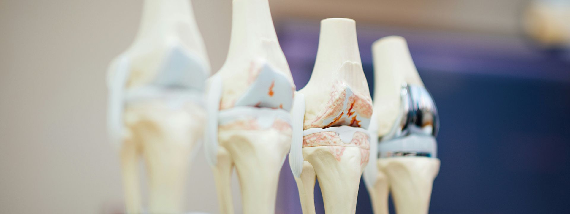 Kniechirurgie mit Fokus auf Präzision und Bewegung